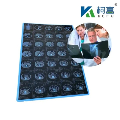 125 Micron Semi - Transparent White Laser Medical X - Ray PET Plastic Films  Engineered To Excel In Medical