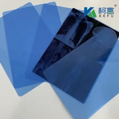 200±5μm X-ray Film For Clear And Accurate Medical Interpretation