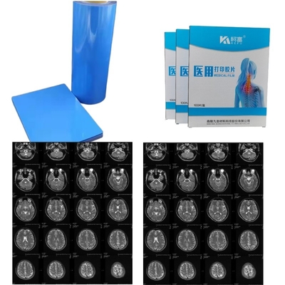 Medical Image Dry PET Inkjet Laser Medical X-Ray Film 14x17 Inch