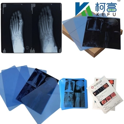 14*17 Inch Medical X-Ray/CT/DR Dry Scan Film For X-Ray Laser Image Printer And Thermal Image Printer Equipment