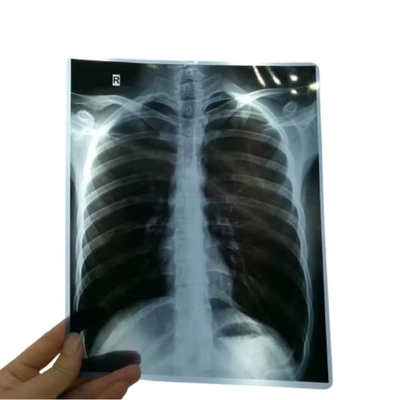 14*17 Inch Medical X-Ray/CT/DR Dry Scan Film For X-Ray Laser Image Printer And Thermal Image Printer Equipment