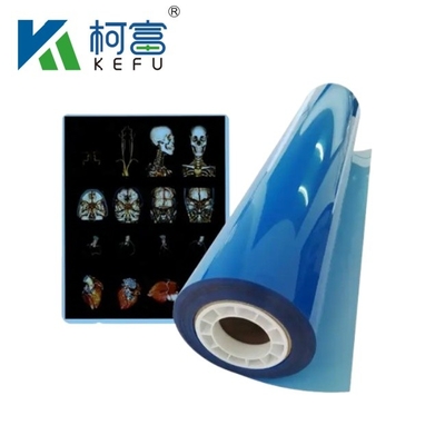 Customized Size Blue White Inkjet Medical X Ray Film For Inkjet Printers In Sheets