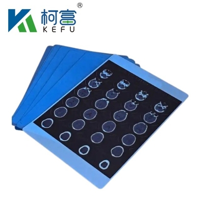 Medical Image Dry PET Inkjet Blue Film Medical X-ray Film Customized Size