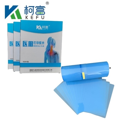 Medical Image Dry PET Inkjet Blue Film Medical X-ray Film Customized Size