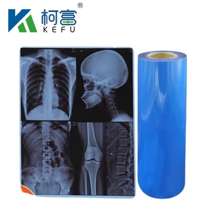 Waterproof Medical X-Ray Thermal Film X Ray Blue Film For Inkjet Printers
