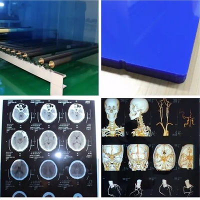 Waterproof Medical X-Ray Thermal Film X Ray Blue Film For Inkjet Printers