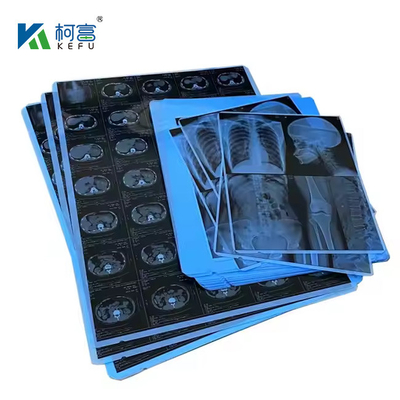 Blue PET Based X Ray Thermal / Inkjet Film Medical Images For Clinic And Hospitals