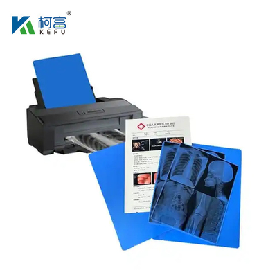 Multiple Size Blue White Transparent Inkjet/Laser Medical Film X- Ray Film