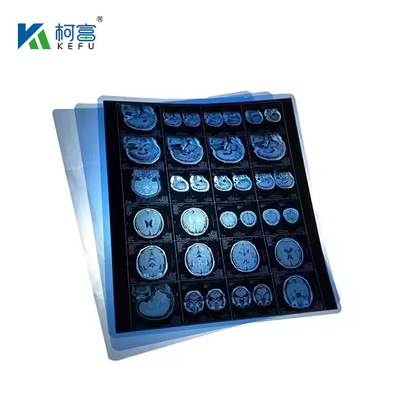 Blue White Transparent Inkjet / Laser Medical Film X- Ray Film