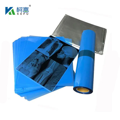 175mic 215mic High Definition Medical Imaging CT DR Inkjet Blue Film Medical X-ray Pet Film A3 A4 Transparent Blue Printing Film