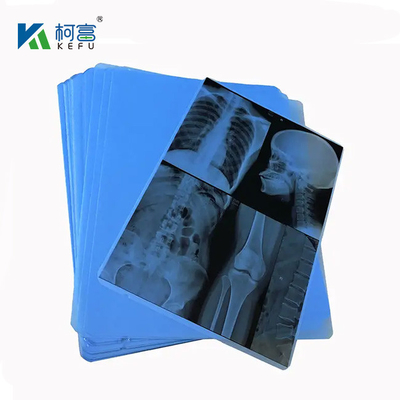 100 Pieces Per Pack A4 14''x17'' Medical Inkjet X-ray Imaging Blue Film For Medical Devices