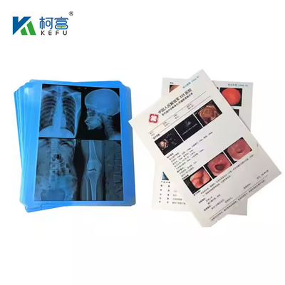 Factory Wholesale Price PET X-Ray Imaging Print Film Waterproof Medical Blue Base Dry Film
