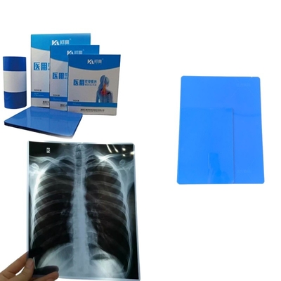 CT Scanner Dry X-ray A3 / A4 Medical Ink Jet Blue Film X-ray PET Film