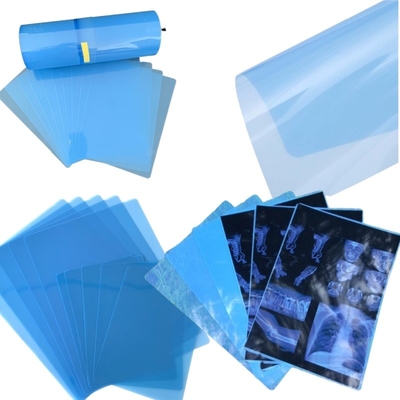 CT Scanner Dry X-ray A3 / A4 Medical Ink Jet Blue Film X-ray PET Film