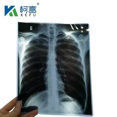 8x10 Inch 14x17 Inch Blue Medical X Ray Film Substitute Fuji Medical Dry Film For Clinic And Hospitals