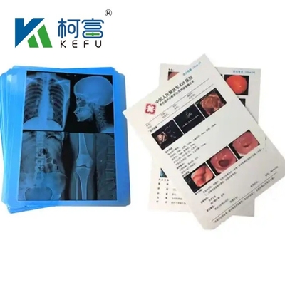 14&quot;*17&quot; High Quality X Ray Film Medical Blue Dry Thermal Film For Hospital Medial Devices