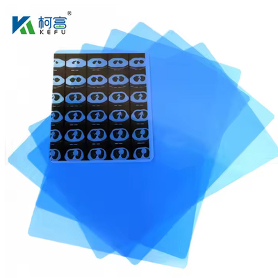 14*17in Medical X-Ray/CT/DR Dry Scan Film For X-Ray Laser Image Printer And Thermal Image Printer Equipment