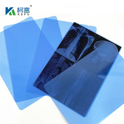 14*17in Medical X-Ray/CT/DR Dry Scan Film For X-Ray Laser Image Printer And Thermal Image Printer Equipment