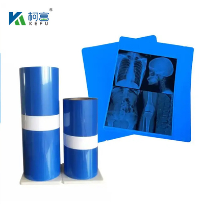 14*17in Medical X-Ray/CT/DR Dry Scan Film For X-Ray Laser Image Printer And Thermal Image Printer Equipment
