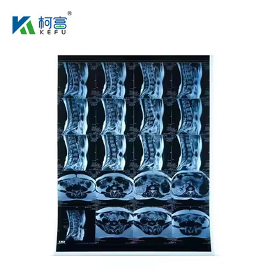 Inkjet Medical X-RAY Blue Film 210micron CT DR Film A4 8x10 Sheet Or Roll For Medical Inkjet Printing Media