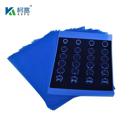 Diagnostic Accuracy Medical X Ray Film With High Fidelity Color Reproduction