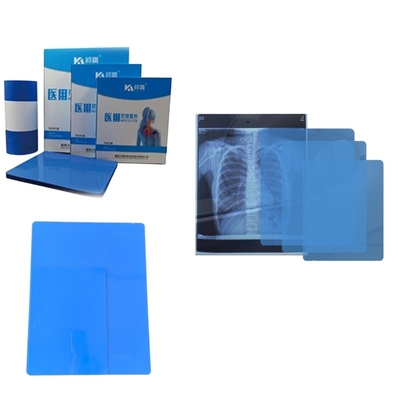 Free Sample Inkjet X Ray Paper Film Imaging Printed By Printer For Radiology Medical Diagnosis 8*10 Printer