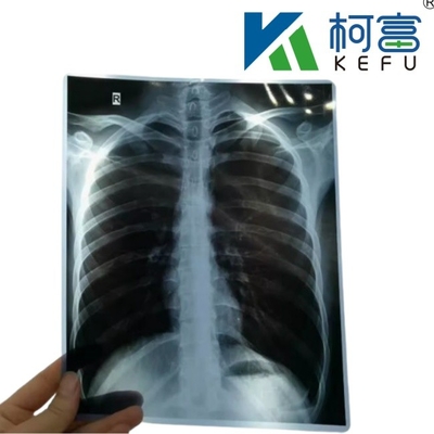 Free Sample Inkjet X Ray Paper Film Imaging Printed By Printer For Radiology Medical Diagnosis 8*10 Printer