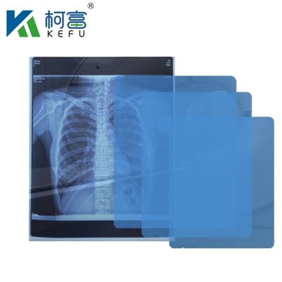 High Definition Medical Imaging CT DR Inkjet Medical X-ray Pet Film 175mic 215mic Transparent Blue Printing Film