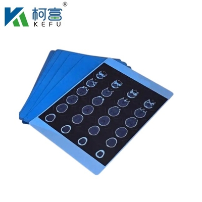 Medical X-Ray/CT/DR Dry Scan Film For X-Ray Laser Image Printer And Thermal Image Printer Equipment