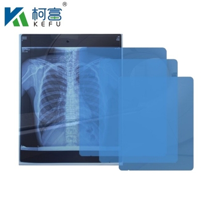 Customized Size Medical X Ray Film Blue Sensitive Medical X Ray Film Inkjet Medical Film