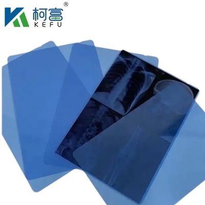 Laser Thermal Printing X Ray Films Semi-Transparent X-ray Inkjet Medical Blue Film