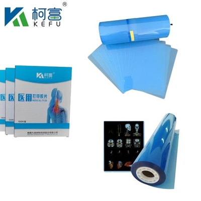 High Contrast  Laser Film Inkjet Medical Film Blue PET X-Ray Film For Inkjet And Laser Printers