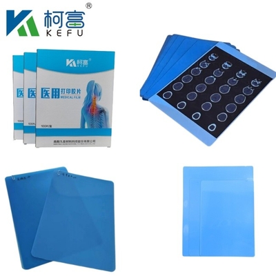 CT Scanner Dry X-ray A3 / A4 Medical Ink Jet Blue Film X-ray PET Film