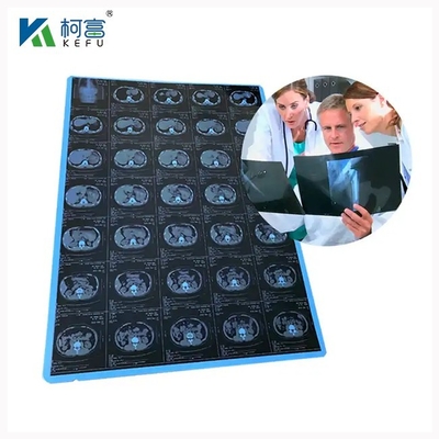 Scratch - Resistant And Durable Medical Laser Film 6x8in 0.10mm Ensuring Long Term Use In Busy Medical Environments