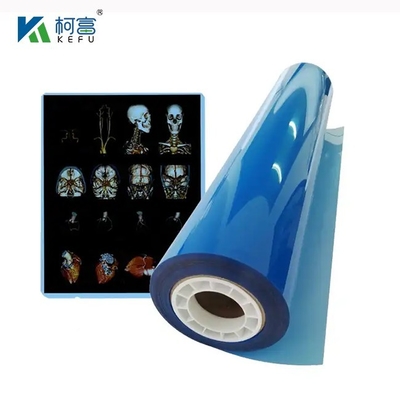 High Definition And Wide Gamut Medical Laser Film 17x22in 0.17mm For Detailed And Vivid Medical Examinations
