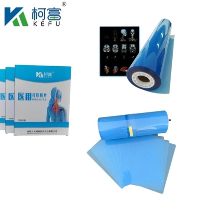 Blue Inkjet Film Medical X-Ray/CT/DR Dry Scan Film For X-Ray Laser Image Printer And Thermal Image Printer Equipment