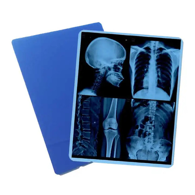 Introducing 125 Micron Semi - Transparent White Laser Medical X - Ray PET Plastic Films For Medical Requirements
