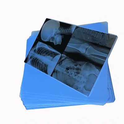 Discover 125 Micron Semi - Transparent White Laser Medical X - Ray PET Plastic Films For Medical Applications