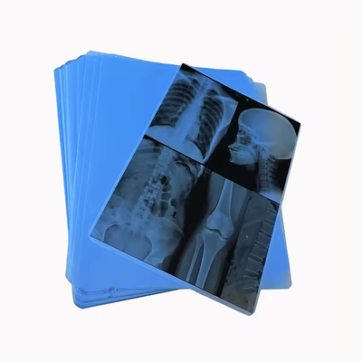 Industry Leading Production Our Professionally Produced Medical Blue X - Ray Film For Laser Printing Is The Go - To Choice.