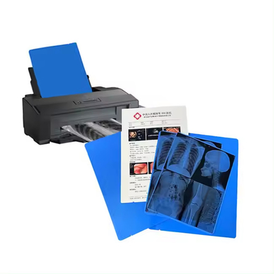 Medical Blue X - Ray Film For Laser Printing Precise Diagnosis