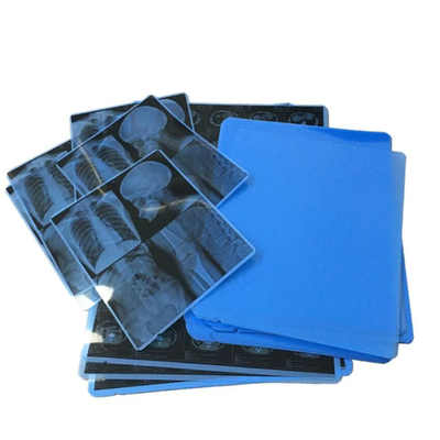 Medical Blue X - Ray Film For Laser Printing Precise Diagnosis