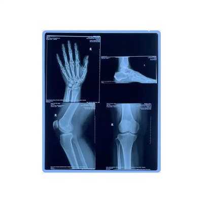 11*14 Size Medical Blue X Ray Film For Laser Printing