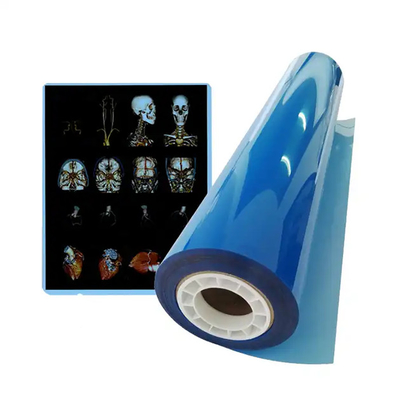 11*14 Size Medical Blue X Ray Film For Laser Printing