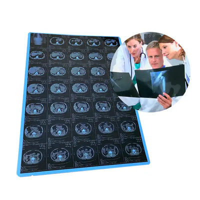 11*14 Size Medical Blue X Ray Film For Laser Printing