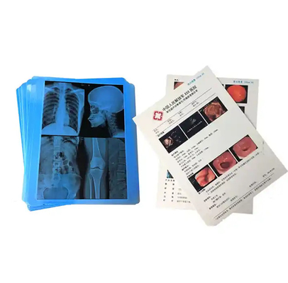 Medical Blue X - Ray Film For Laser Printing   Medical Hosiptal Consuables