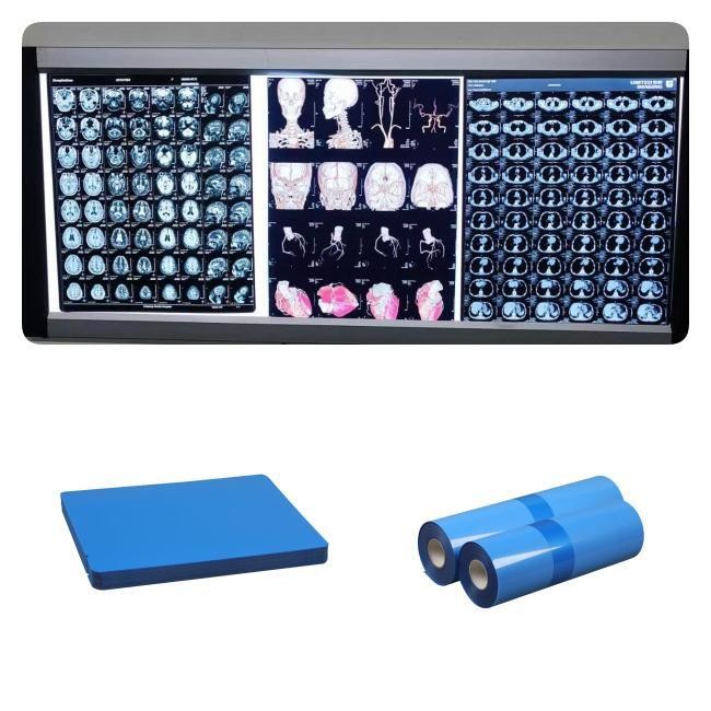 DR CT MRI Medical Inkjet X Ray Films 210 Microns Blue Base Ink 8x10 A4 ...