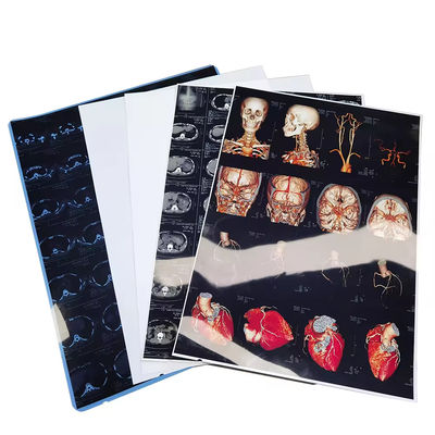 High Resolution Blue White Medical X Ray Films With Glossy Surface Finish
