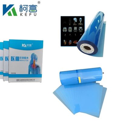 CT Scanner Dry X-ray A3 / A4 Medical Ink Jet Blue Film X-ray PET Film
