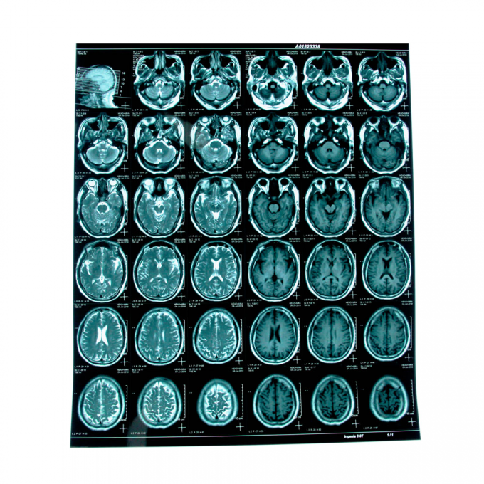 Blue Inkjet Medical X Ray Film Medical Dry Film A4 A3 Sheets Or In Rolls 0