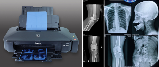 Medical X Ray Film Dry Thermal For Printer 3